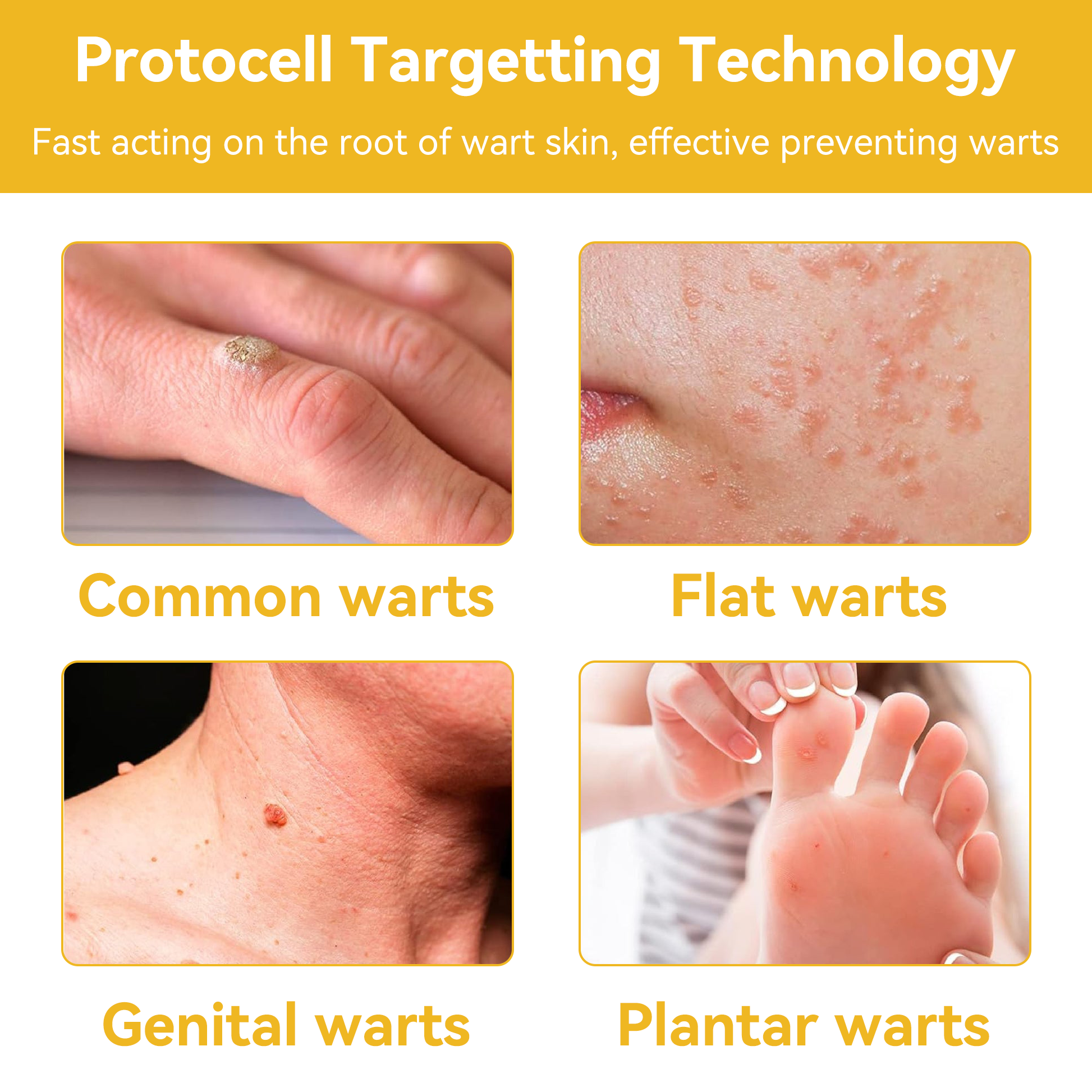 1+1 Free | TagAway™ - Effective removal of warts and skin growths