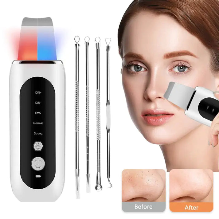 SkinPleasure™ - Ultrasonic Facial Scrubber - An easy way to tighten your skin! [Last Day Discount]