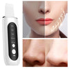 SkinPleasure™ - Ultrasonic Facial Scrubber - An easy way to tighten your skin! [Last Day Discount]