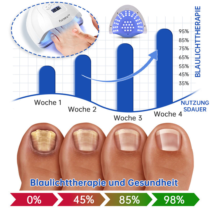 PureNail | Pilz-Lasertherapiegerät - Ihre Geheimwaffe gegen Nagelpilz