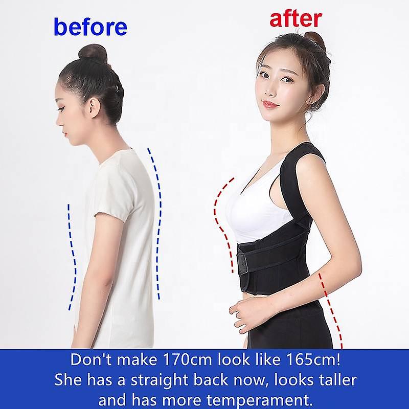 PosturEase™ - Posture Corrector [Last Day Discount]