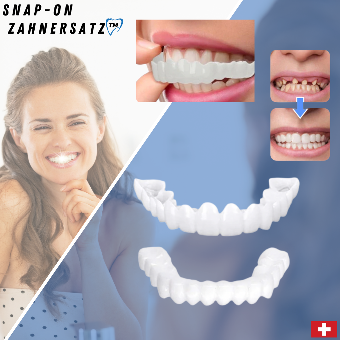 (50% off) Snap-On Dentures™ - Always the perfect bright white smile!【Last day discount】