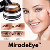 1+1 FREE | MiracleEye™ | Wrinkle Eraser Firming Eye Cream [Last Day Discount]