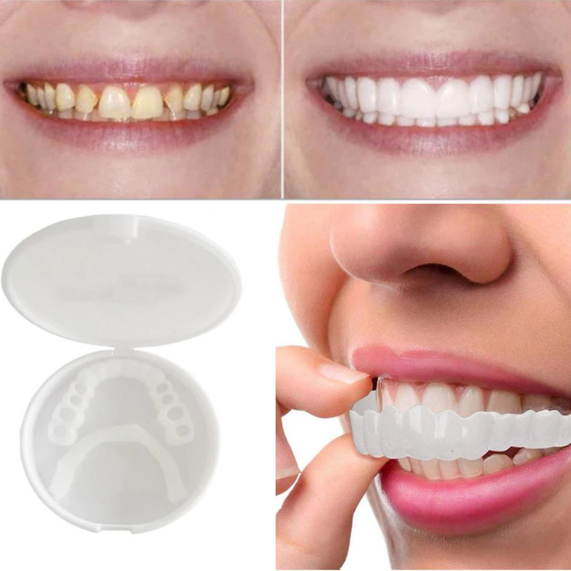 (50% off) Snap-On Dentures™ - Always the perfect bright white smile!【Last day discount】