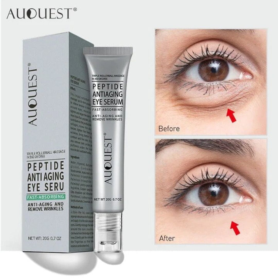 1+1 FREE | Auquest® | Anti Aging &amp; Wrinkle Removing Eye Cream【Last day discount】