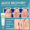 Nail Repair™ - Fast and effective results! [Last day discount]